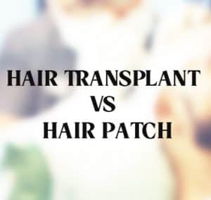Hair transplant versus cosmetic hair patches