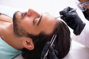 Best Hair Transplant Clinic In Tijuana