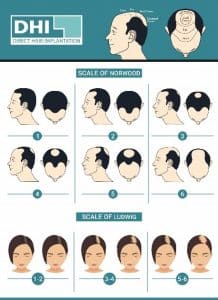 Hair Loss Scale Norwood and Ludwig Scale