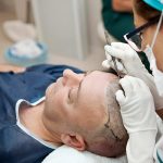 Cost of a DHI Hair Transplant in Brazil