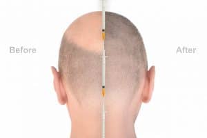 Hair transplant clinic