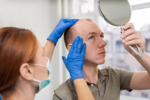 Hair Transplant Solutions for Post-Weight Loss 