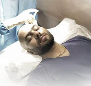 Celebrities hair transplant transplant