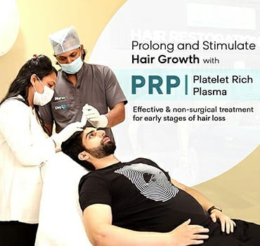 prp hair loss treatment dhi international