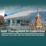 Hair Transplant