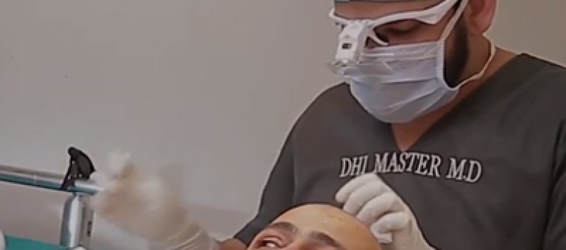 The Best Place to Get a Hair Transplant